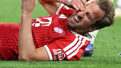 Bayern striker Harry Kane after taking a blow to the face. Reuters