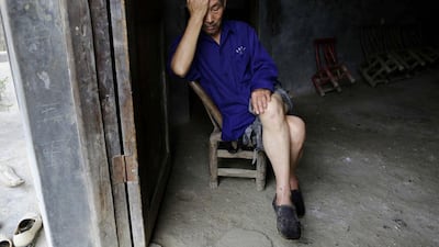 Gong Zhaoyuan, 69, who was diagnosed with skin cancer, reacts as he rests at his home in Heshan village. Jason Lee / Reuters