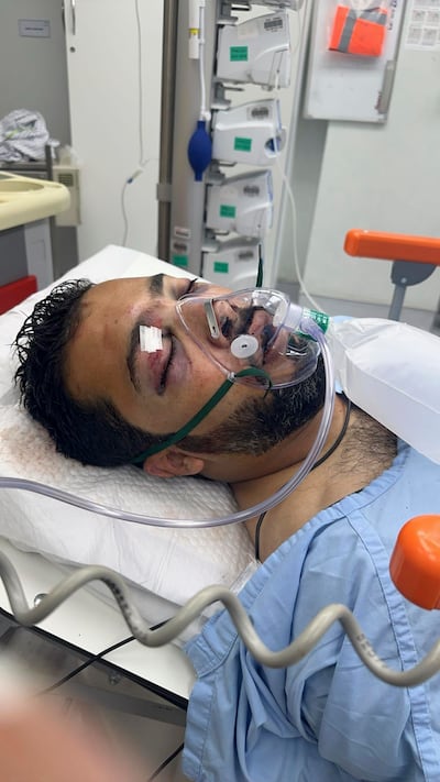 Juma Almheiri was given a one-in-10 chance of survival after his 4x4 was involved in a rear-end collision with a cement lorry in Dubai. Supplied/The National