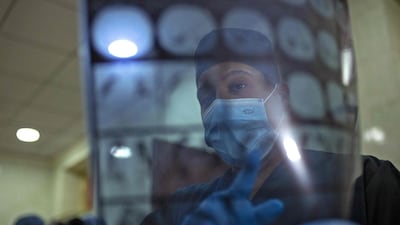 A medical staffer wearing protective gear inspects chest X-ray scans at Basra University Hospital, where Covid-19 coronavirus patients are treated, in the southern Iraqi city. AFP