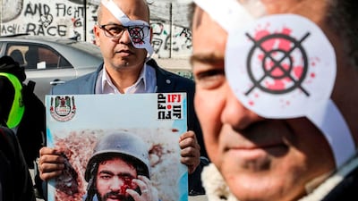 Palestinian journalists wear paper eye patches at a demonstration near Israel's controversial separation barrier in Bethlehem in the occupied West Bank. AFP