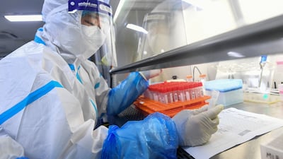 A laboratory technician works on samples to be tested for the coronavirus at the Fire Eye laboratory in Wuhan, China, on August 4. AFP