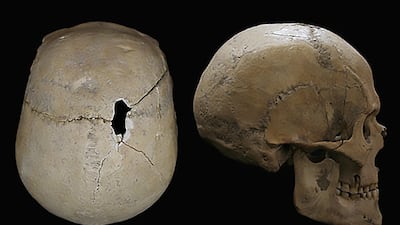 He was about 55 when he died, was 178cm tall and weighed about 70kg. His diet consisted mostly of fish. Photo: Expo Serbia Pavilion