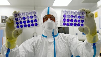 Sequencing samples of the virus helps scientists detect new strains, which can inform policy. AFP