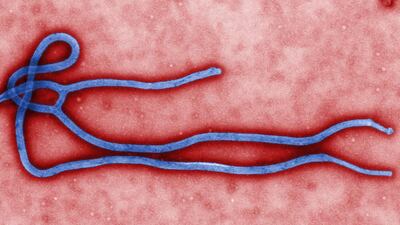 A colorized transmission electron micrograph (TEM) of an Ebola virus virion. Cynthia Goldsmith / EPA