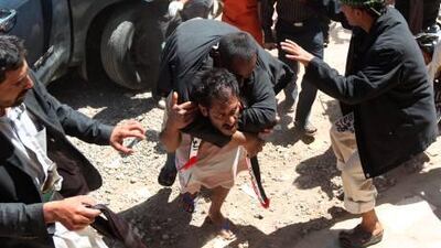 A Yemeni carries his wounded colleague into a makeshift hospital in Sanaa on October 18, 2011. At least five pro-democracy protesters were killed and dozens wounded when gumnen loyal to embattled Yemeni President Ali Abdullah Saleh opened fire on them.