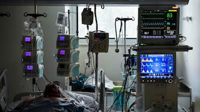 A COVID-19-infected patient is seen at the Intensive Care Unit, in the Emilio Ribas hospital in Sao Paulo, Brazil. On October 10, Brazil passed the bleak marker of 150,000 deaths from Covid-19, the health ministry said, as the rate of coronavirus infections continues to slow in the South American country. AFP