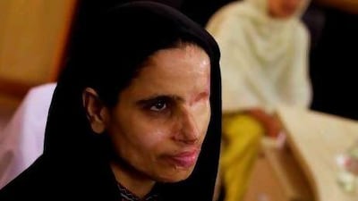Zakia, an acid attack survivor, fears the backlash the film could bring at home.