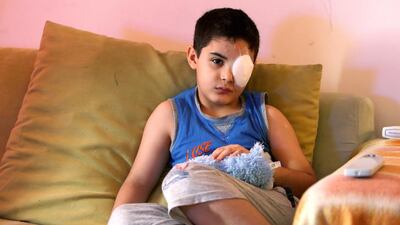 Yousef ben Lafi, whose left eye was damaged by hand sanitiser that spurted out of a dispenser in a hospital, has surprised doctors with a remarkable recovery, thanks to regenerating stem cells. Pawan Singh / The National