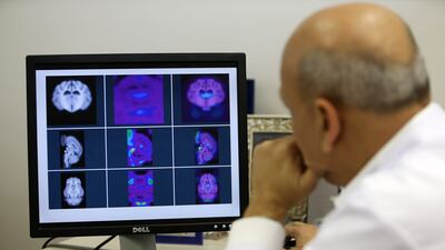 Recorded strokes have increased by 70 per cent around the world since 1990, due to changes in lifestyle, environmental factors and also better diagnoses. Pawan Singh / The National