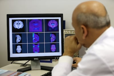 Recorded strokes have increased by 70 per cent around the world since 1990, due to changes in lifestyle, environmental factors and also better diagnoses. Pawan Singh / The National