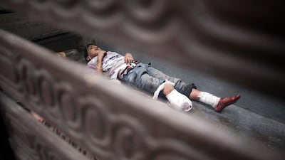 With such a shortage of beds, a Syrian child, wounded by Syrian Army shelling, lies in a lorry after being treated by doctors at Dar Al Shifa hospital.
