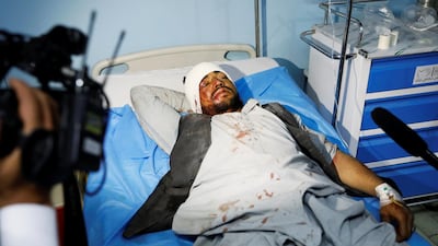 ATTENTION EDITORS - SENSITIVE MATERIAL. THIS IMAGE MAY OFFEND OR DISTURB An injured man recevies treatment at a hospital after a blast in Kabul, Afghanistan, August 7, 2019. REUTERS/Mohammad Ismail