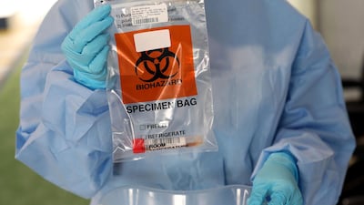 The new screening drive through for COVID-19, Zayed Sports City, Abu Dhabi. Chris Whiteoak / The National