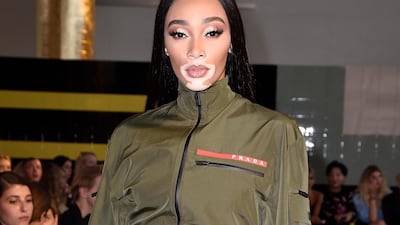Canadian model and vitiligo spokesperson Winnie Harlow at the Prada show at Milan Fashion Week. Photo: Pietro D'Aprano / Getty Images for Prada