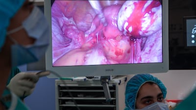 The surgery is minimally invasive and allows a surgeon to access the inside of the abdomen through tiny hole-size cuts without making large incisions in the skin. It is the gold standard for accurate diagnosis and surgical treatment.