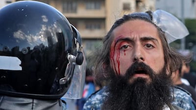 An injured man stands near Lebanese security forces trying to prevent clashes between demonstrators and counter-protesters in the centre of the capital Beirut during the 13th day of anti-government protests. AFP