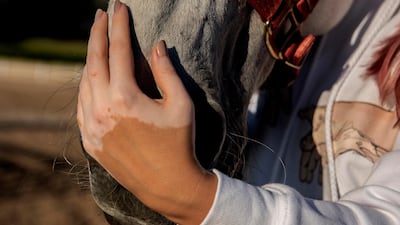 Nadin Al Maskari is comfortable in her own skin and wants others to be too. All pictures by Vidhyaa Chandramohan for The National