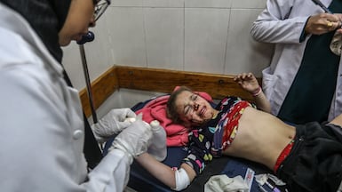 Doctors at Nasser Hospital in Khan Younis, southern Gaza, treat a child injured by an Israeli drone attack on a tent in the Al Mawasi area on January 5, 2026. Getty Images