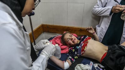 Doctors at Nasser Hospital in Khan Younis, southern Gaza, treat a child injured by an Israeli drone attack on a tent in the Al Mawasi area on January 5, 2026. Getty Images
