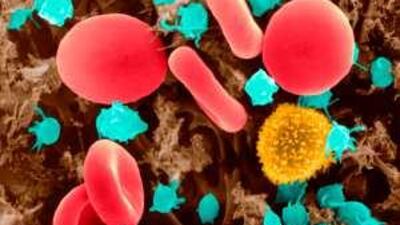 Two British scientists are treating rheumatoid arthritis and multiple sclerosis by destroying patients' B-cells and starting over with fresh ones.