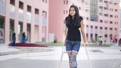 The next challenge for Atrayee Das, 12, is catching up on her schoolwork after the operation. Reem Mohammed / The National