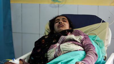 An Afghan Sikh woman wounded in a gunmen attack lies in a hospital in Kabul, Afghanistan. AP Photo