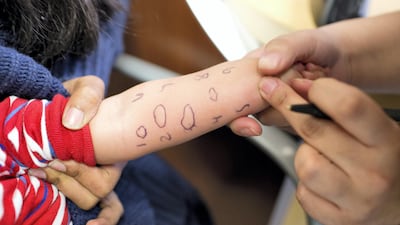 Children often outgrow their allergies. Getty Images