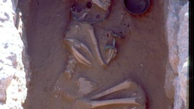 A human skeleton with what looks like a bowl.