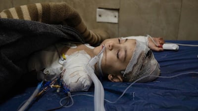 Syrian boy Ibrahim, who lost an arm and was severely injured as government forces and Kurdish militias clashed in Aleppo, receives treatment at Al Razi Hospital, in the northern city. All photos: Anagha Nair for The National