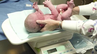 The UAE’s rate of Caesarean births, which continues to be above the World Health Organisation’s recommended rates of 19 to 21 per cent, is a matter of concern. istockphoto.com