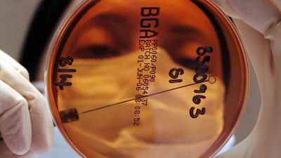 Norovirus cases have been surging in recent weeks. PA