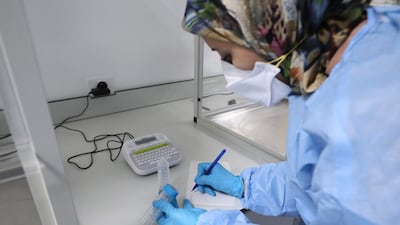 A lab technician gathers a sample from remains for DNA identification and genetic matching in Tripoli. AFP