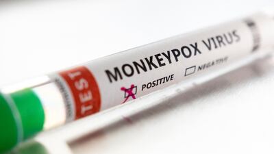 The UK health authority is recommending third-generation smallpox vaccine for those with monkeypox. Reuters