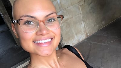 Yasmin Taylor says social media helped her embrace her bald head and inspired others to do so, too. Yasmin Taylor / Instagram