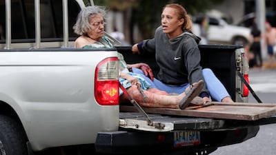 An injured woman in Caracas. EPA