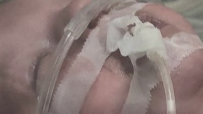 Gaza hospitals warn of critical oxygen shortage