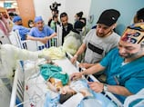 Saudi surgeons separate conjoined Syrian twins