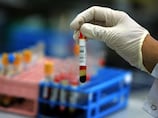 How simple test for killer cholesterol can prevent fatal heart attacks