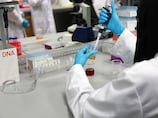 Abu Dhabi to host clinical trial of proactive treatment that aims to prevent Alzheimer's disease