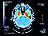 Abu Dhabi researchers identify molecule primed to boost fight against Parkinson's disease
