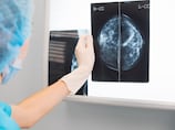 Long-term study links Type 2 diabetes with cancer - with women facing double the risk
